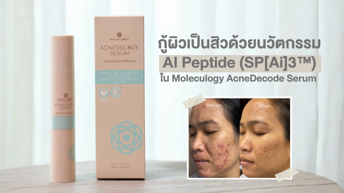 กู้ผิวเป็นสิวด้วยนวัตกรรม AI Peptide (SP[Ai]3™) ใน Moleculogy AcneDecode Serum